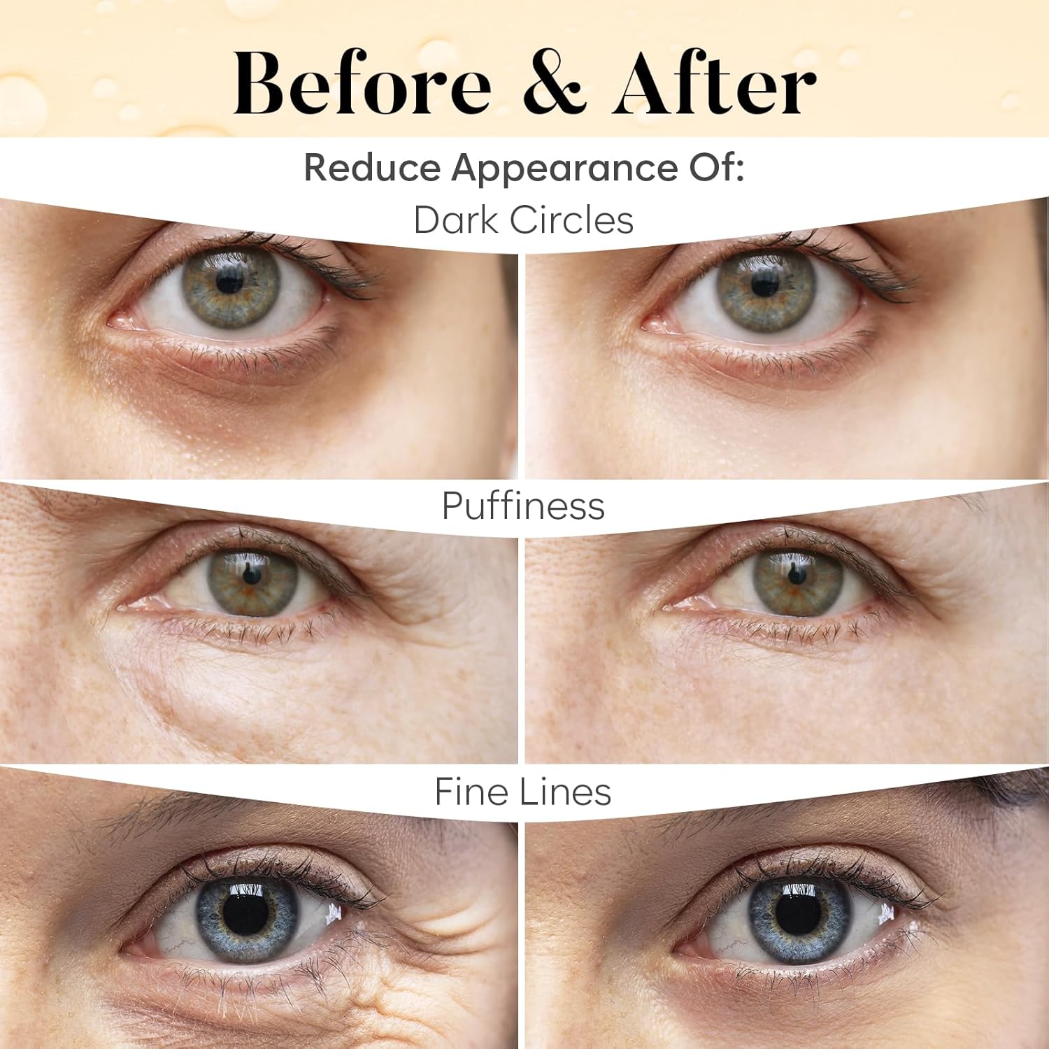 AURAE Vitamin C & Caffeine Under Eye Patches (30 Pairs), Under Eye Mask for Puffy Eyes, Appearance of Dark Circles, Smoothing & Hydration, Self Care & Skincare Gifts for Women, Patch Yeux