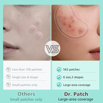 563 Count Pimple Patches - Hydrocolloid Acne Patches for Face & Body, Invisible Thin, Large & Small Sizes for Whiteheads, Zits & Breakouts (Dots, Strip, Contoured 6 Sizes)